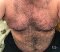 Want a chub? A massage? Older man issues