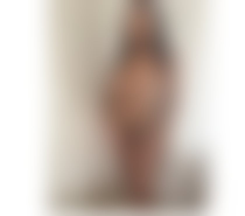 Escorts Bexleyheath Bexley - Photos for New 🆕 ❤️INCALL OUTCALL ❤️💯 REAL