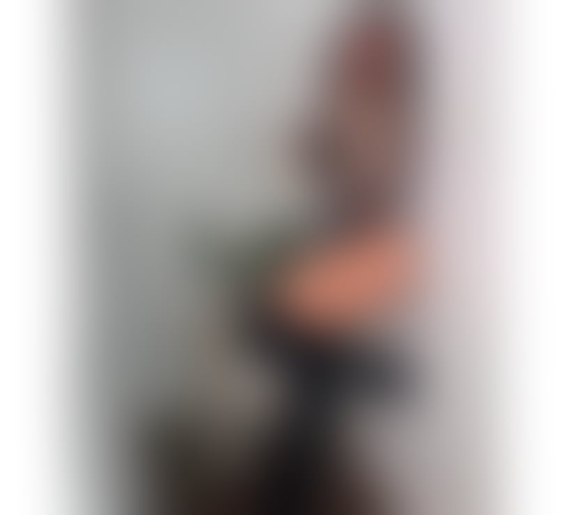 Escorts East London Walthamstow - East London - Photos for 🔥DUDA HOT👅MASSAGE GIRL😈