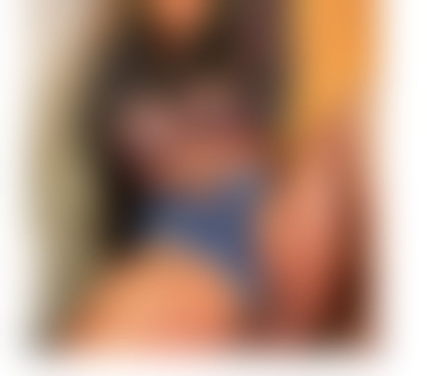 Escorts Fife Dunfermline - Fife - Photos for KATALINA🍒BOMBSHELL💯BEST SERVICE PARTY NO RUSH💯
