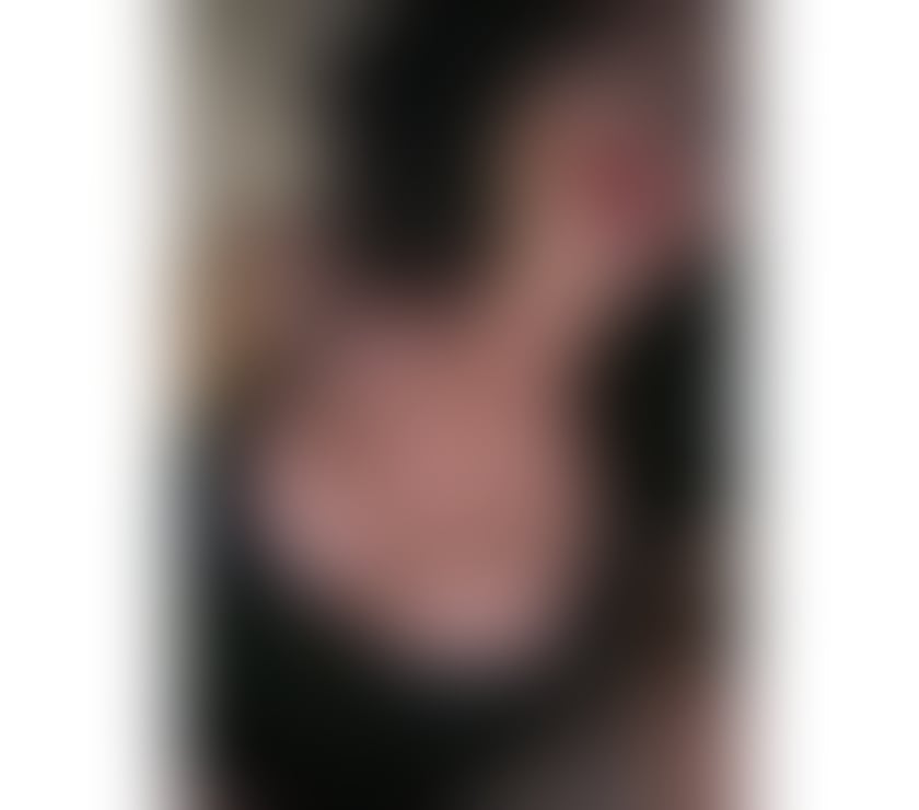 Escorts East London Redbridge - Photos for 🔞AMAZING🍒NEW GIRL IN TOWN🥰BEST SERVICE