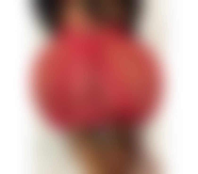 Escorts Kent Thanet - Photos for 💥CARIBBEAN SEXY PARTY GIRL 💯🍫🔞