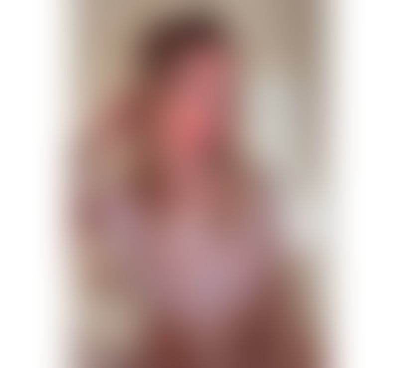Escorts West Midlands Birmingham - Photos for ✨ Blonde Brazilian Girl in Erdington ✨