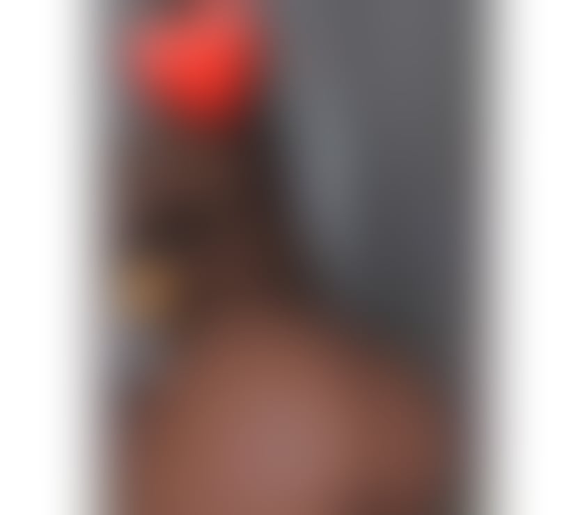 Escorts West Midlands Dudley - Photos for 🔥I’m HERE Love 💗 ONLY OUTCALL 🥂PARTYY💯