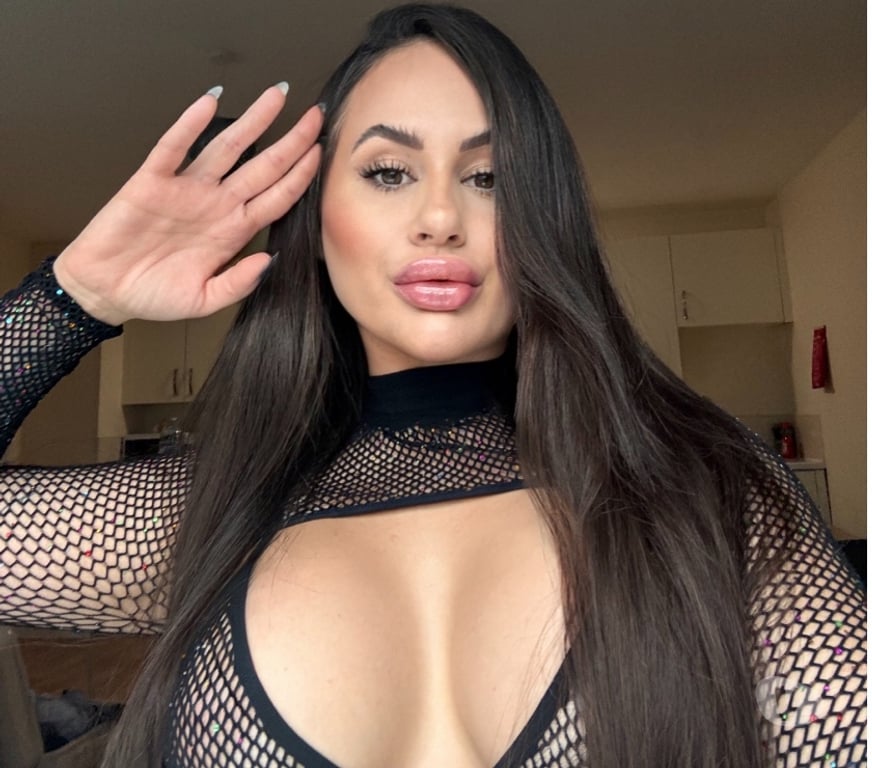 Escorts West Midlands Birmingham - Photos for 🍒CHANTAL ✨ 🍾SEXY PARTY GIRL 🥂💕