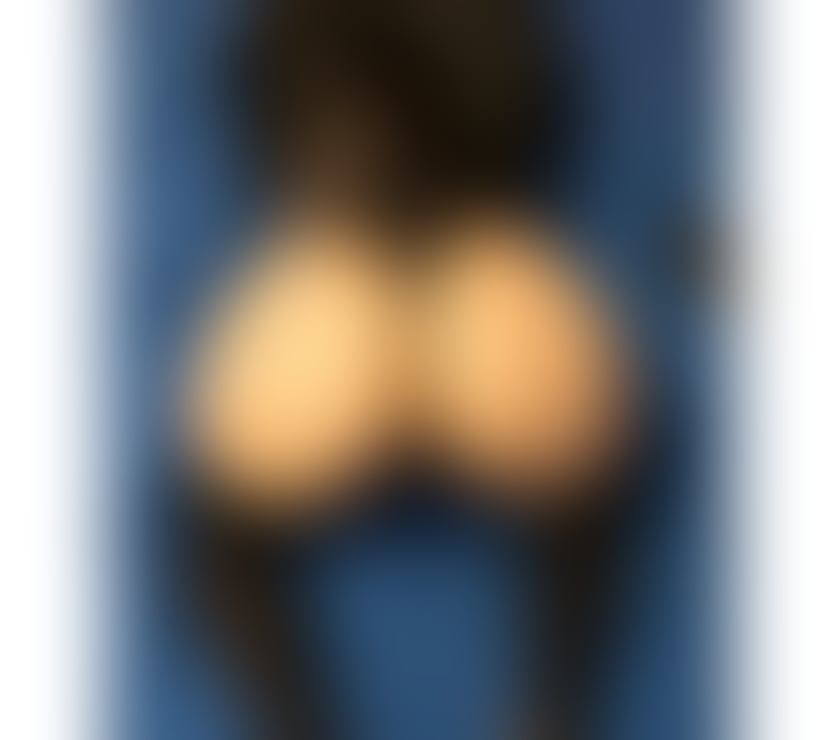 Escorts Erdington Birmingham - Photos for Andrada🩷crazy time with friendly girl🩷