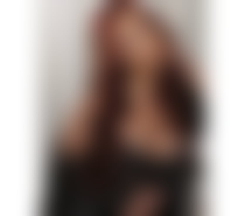 Escorts Hull Hull City Centre - Hull - Photos for LUNA HOT GIRL 🔥✨