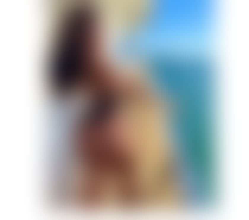 Escorts Kent Medway - Kent - Photos for 🤩 STUNNING GIRL IN TOWN 🤩
