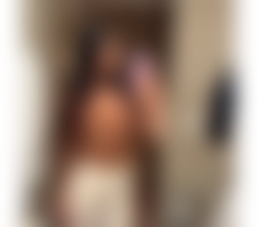 Escorts Surrey Epsom and Ewell - Photos for ✅ ALLINE ✅ REAL YOUNG 🔞 NO RUSH
