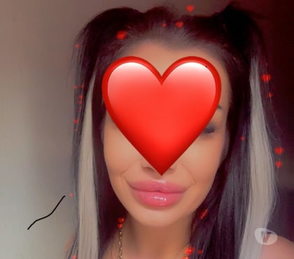  Escorts & Erotic Massage Blackburn Blackburn with Darwen - Photos for 🥂BECKIE 0 7 4 2 5 2 1 3 4 9 1 ❤️incall&outcall
