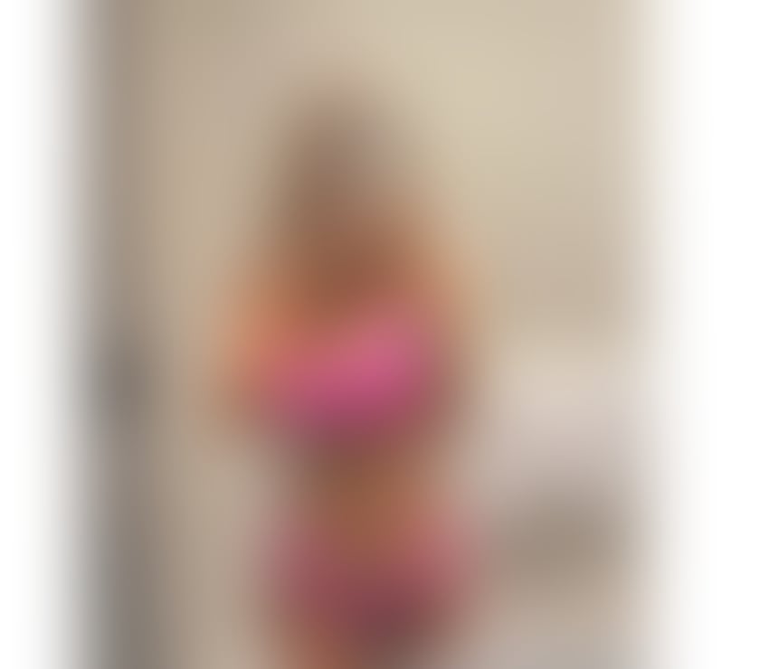 Escorts Dundee Dundee City Centre - Dundee - Photos for BEST SERVICE🔥🔥NO RUSH❤️PARTY