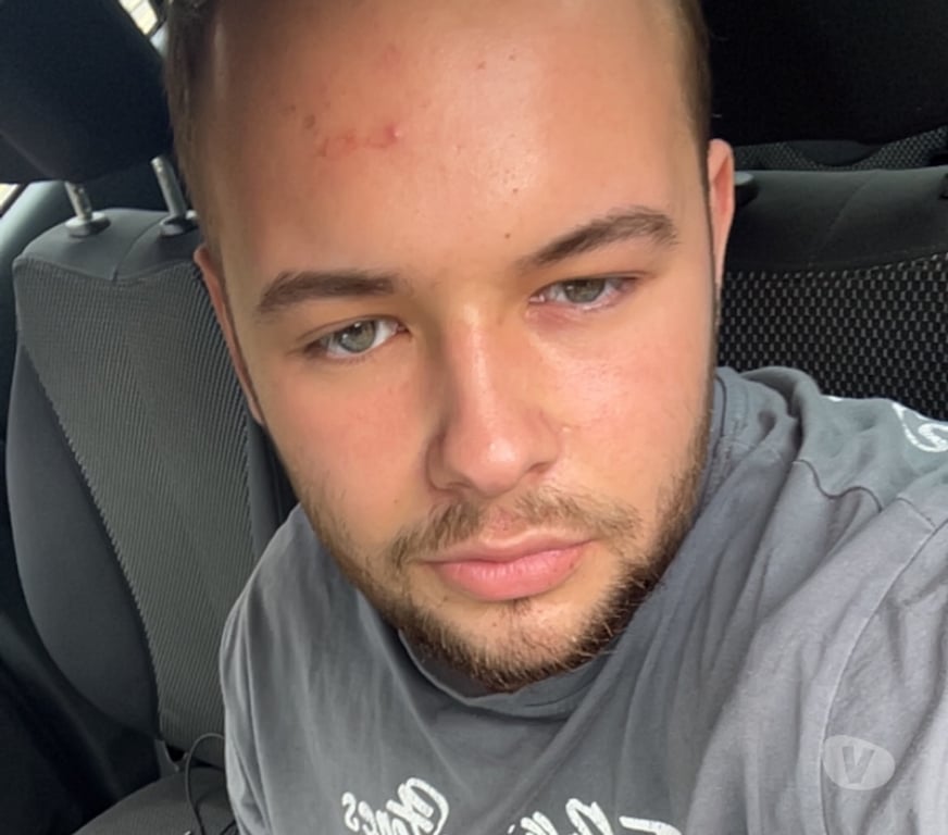  Gay massage Greater Manchester Manchester - Photos for Hairy 19 year old - Manchester Escort