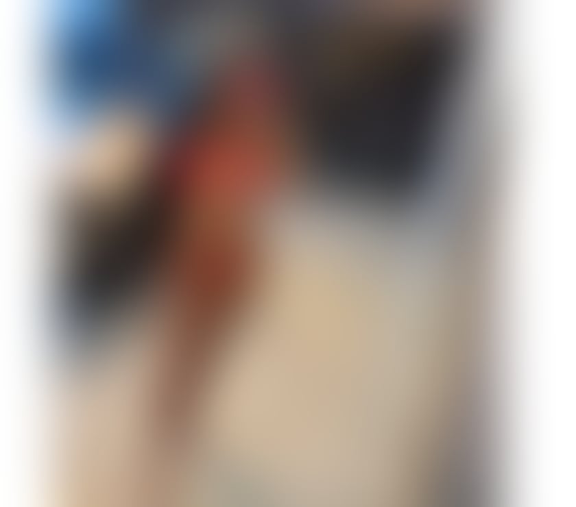 Escorts West Midlands Birmingham - Photos for Duda Hot in Birmingham 🔥🥰
