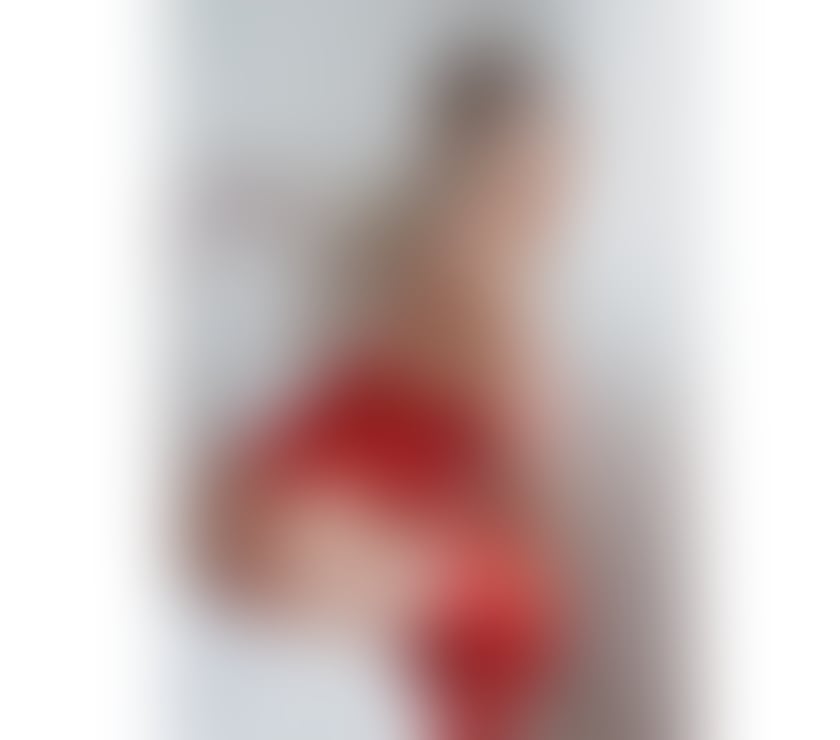 Escorts West Midlands Birmingham - Photos for CHANEL 🔥 HIGH CLASS ❤️‍🔥