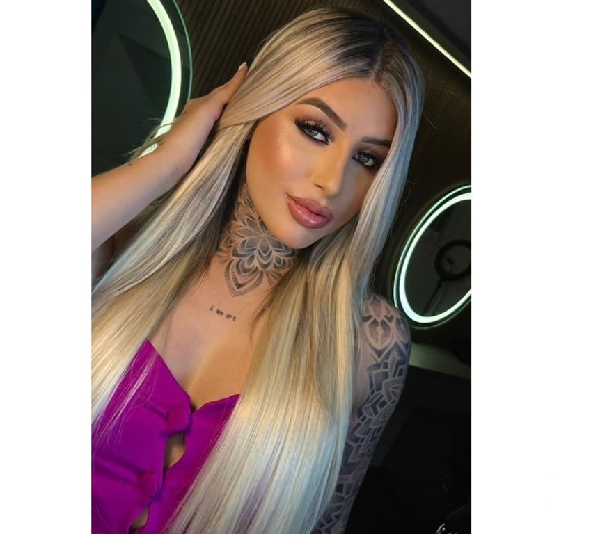 Escorts West Midlands Birmingham - Photos for CHANEL 🔥 HIGH CLASS ❤️‍🔥