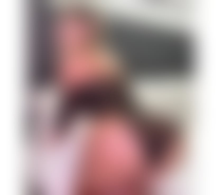 Escorts South East London Bromley - Photos for 🩷BABY FACE🩷 sweet Brazilian Toys 🇧🇷 PARTY GFE