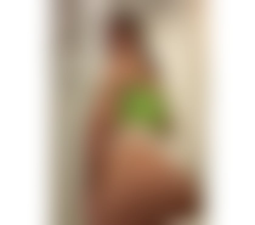 Escorts Kent Gravesham - Photos for 💋YOUNG & BEAUTIFUL- NEW IN TOWN 💋 CALL ME