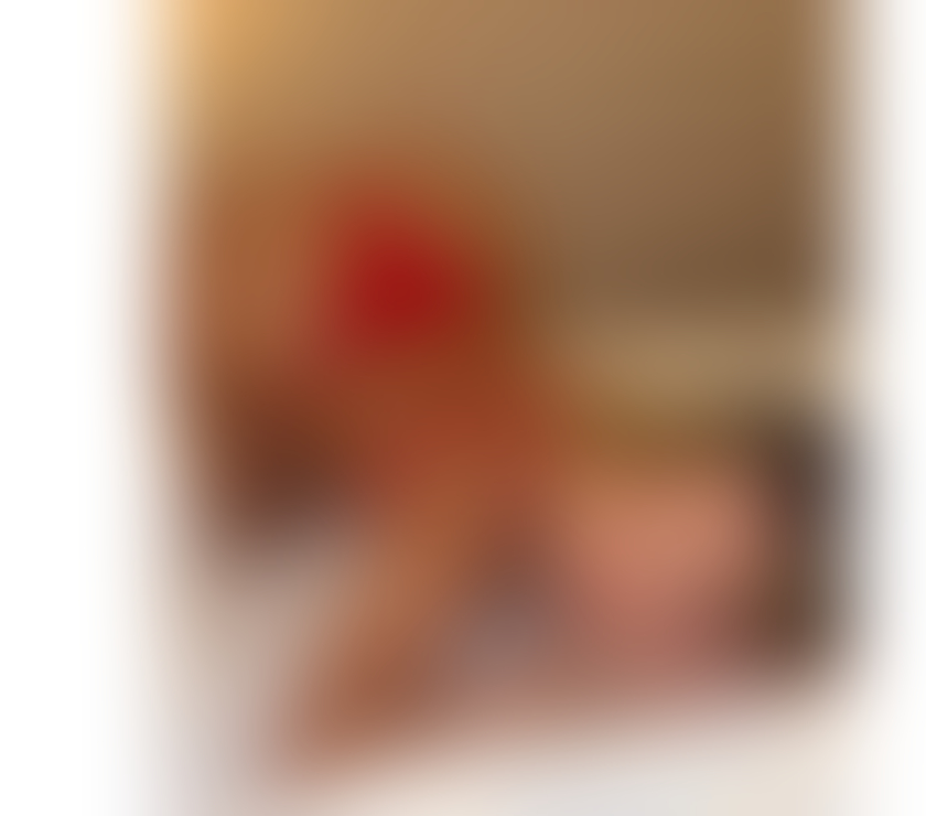 Escorts Shrewsbury Shropshire - Photos for 🍭HELLO IM YANNA BEST OWO FOR YOU🍭