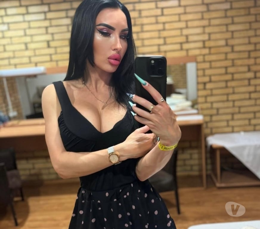 Escorts Hertfordshire Dacorum - Photos for BEAUTY➕HOT BODY✅❤️ PERFECT CHOICE ✅