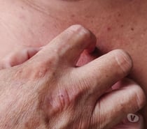 An itch that needs to be scratched!