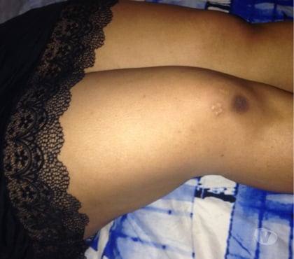 Escorts Hackney Central East London - Photos for New in town . Don't miss out .very nice you will return