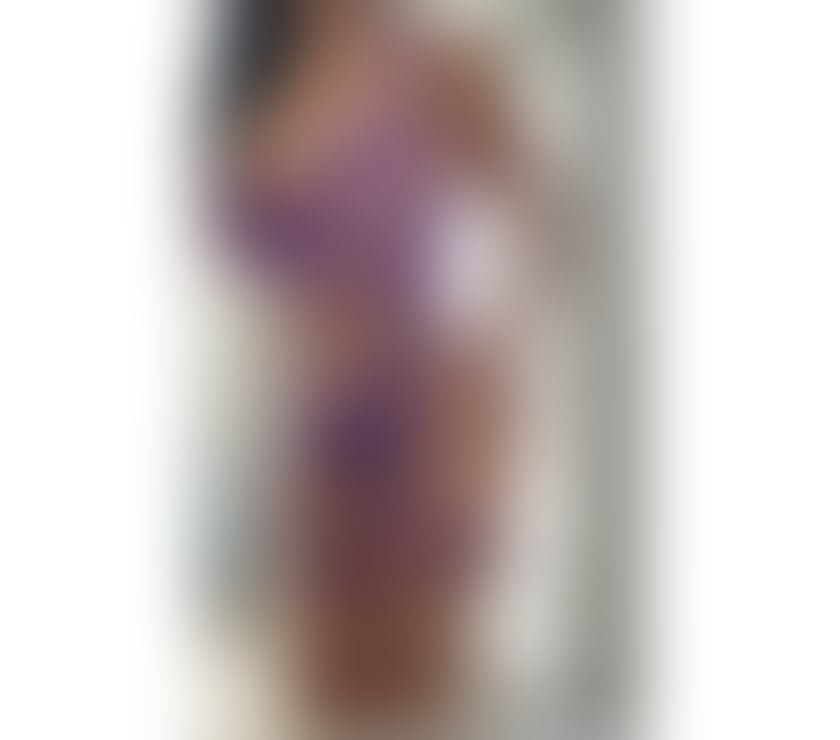 Escorts Kent Tunbridge Wells - Photos for MEL FOXER PPARTY GIRL