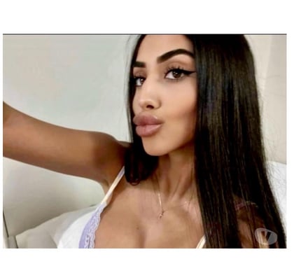 Escorts Cross Green Leeds - Photos for OANA❤️YOUR DREAM GIRL IS HERE🩵BEST SERVICES-GF