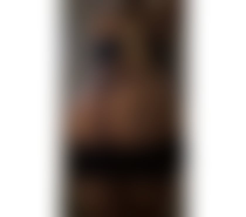 Escorts Shropshire Telford and Wrekin - Photos for 🧨LUXURY escort new here💯real💎