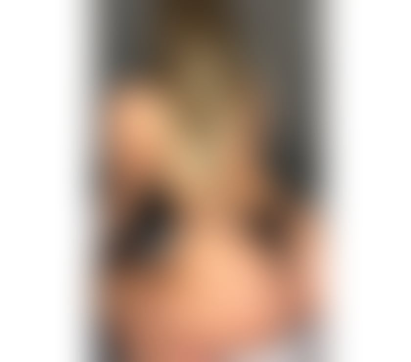 Escorts Kent Thanet - Photos for Alise✅ Real Lady 100% top class escort in you're Town ✅