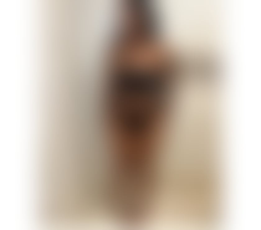 Escorts Kent Dartford - Photos for HI GUYS I'M JADE FROM CARIBBEAN ✨