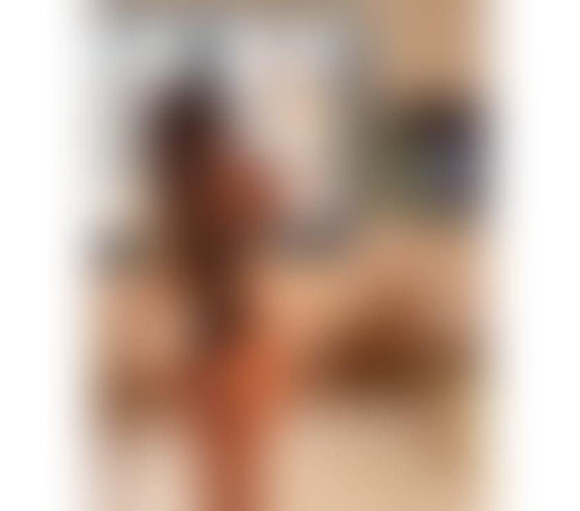 Escorts East London Redbridge - Photos for 24H💋 Lara Blanco 🇨🇴 IG7 - IG5 ✨