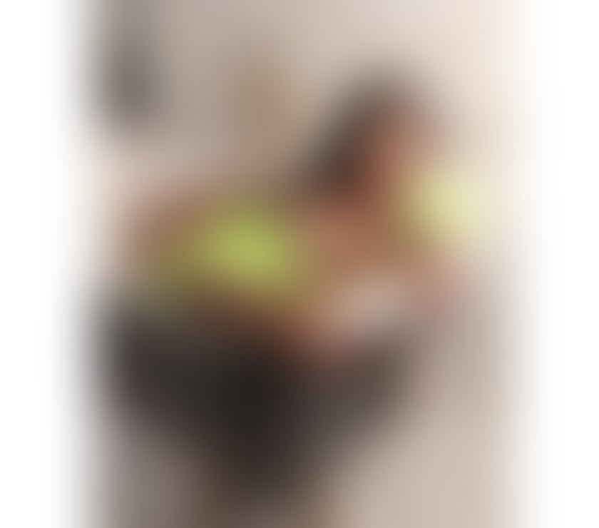 Escorts South East London Catford - South East London - Photos for DULCE🔴PICS REAL💯NO RUSH♥️