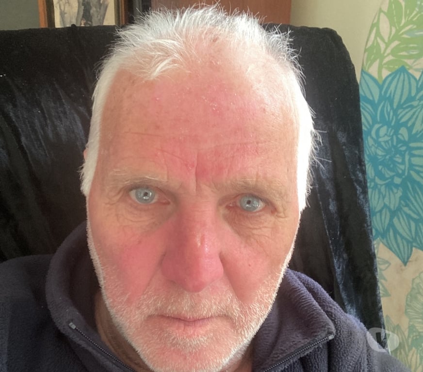 Gay Dating Surrey Elmbridge - Photos for Looking for fun with men a lot younger than my