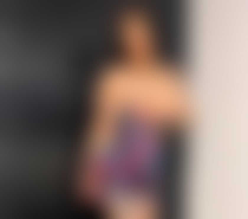 Escorts Stirling Stirling City Centre - Stirling - Photos for 🍒LAURA🔝SWEET 🍭 NAUGHTY 🔝 BRUNETTE🔝NO RUSH💯