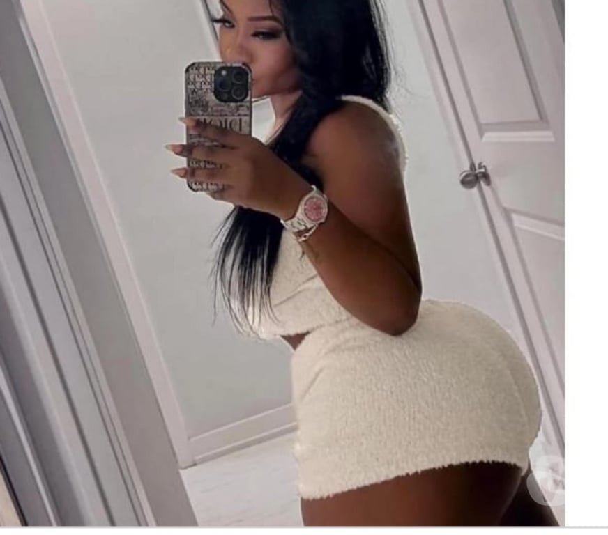 Escorts Glasgow Glasgow City Centre - Glasgow - Photos for The best Owo the best girl🤩WHATSAPP AVAILABLE ✅