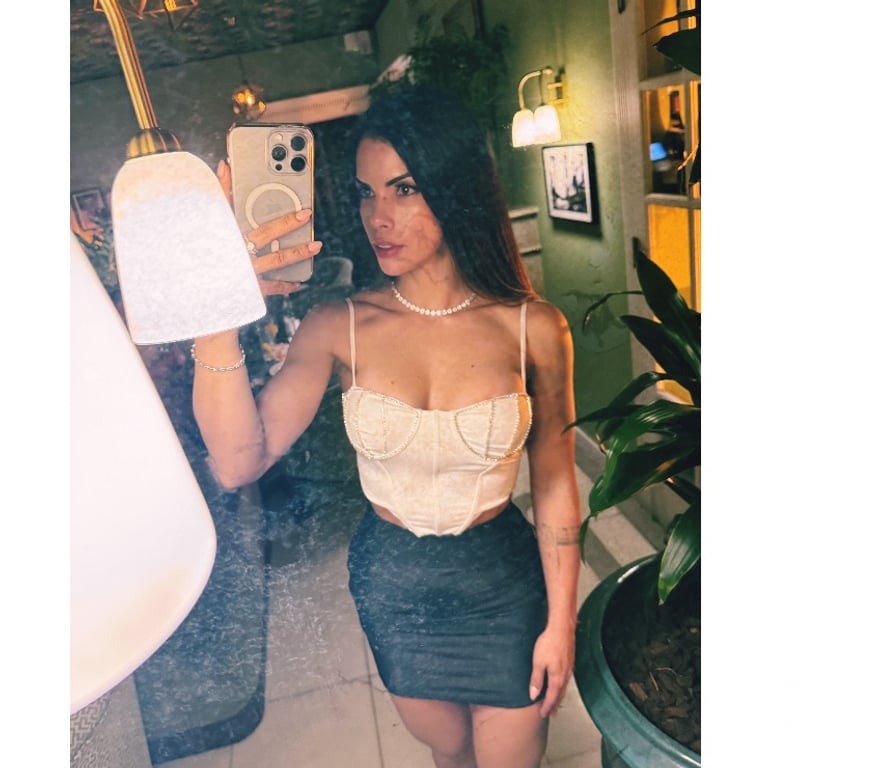 Escorts West Midlands Birmingham - Photos for ✨ New Brazilian Beauty in Birmingham | 100% Real ✨