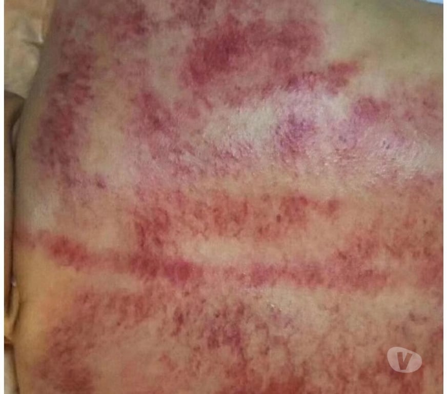 Full body massage Greater Manchester Manchester - Photos for Our Diamond Massage, we offer a variety of professional trea