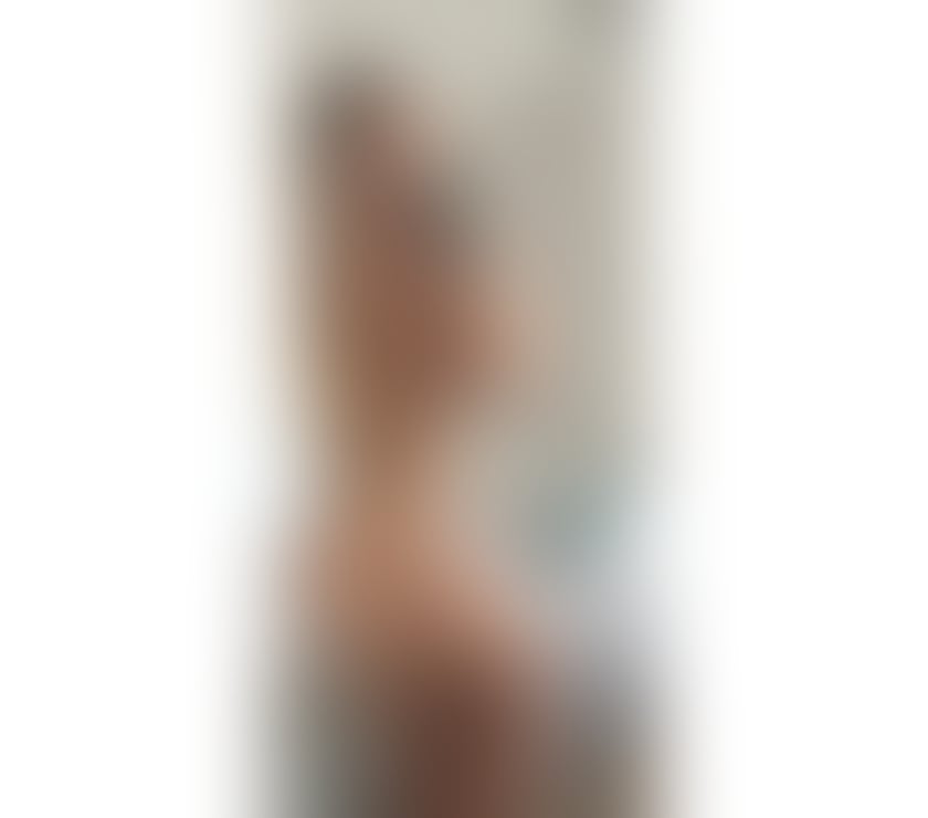 Escorts West London Acton - West London - Photos for UNFORGETTABLE EXPERIENCE🔞🌟FULL SERVICE🍯MEL🍯