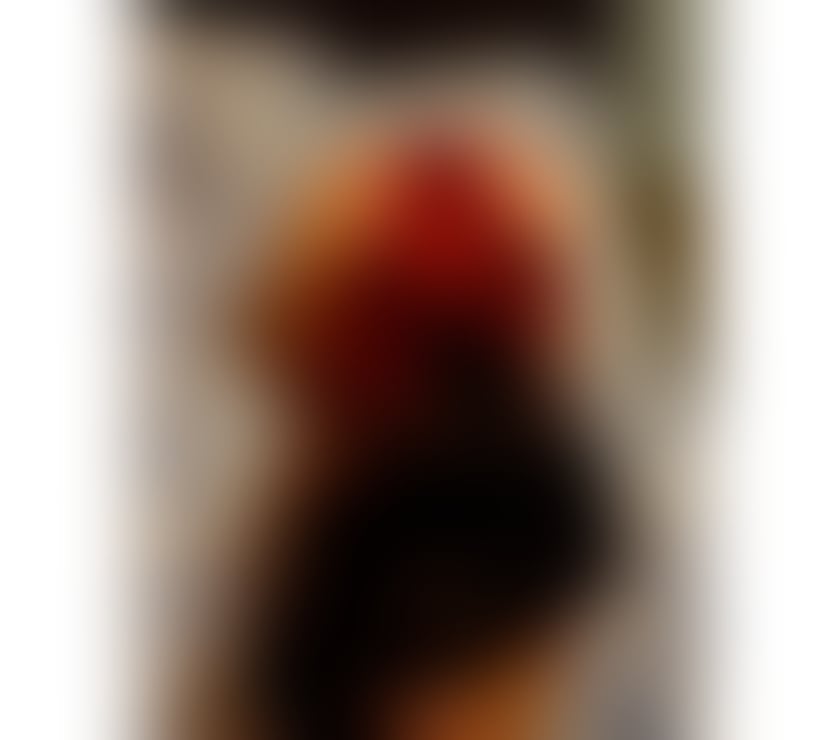 Escorts Halton Widnes - Halton - Photos for THE TURKISH GILR 🇹🇷IS RIGHT NOW IN YOUR TOWN