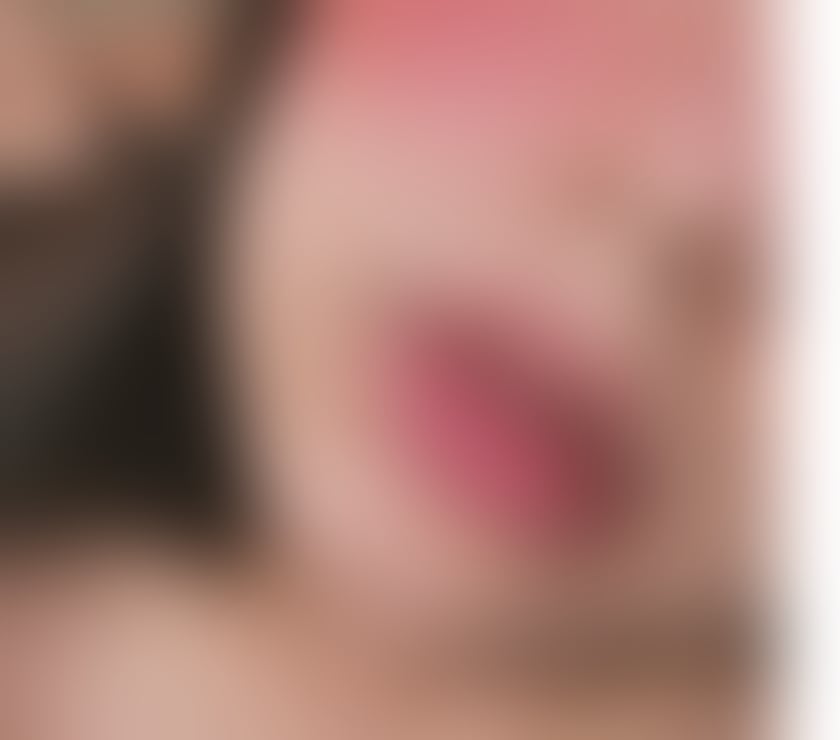 Escorts West Midlands Birmingham - Photos for SCARLETTE🌹BRAZILIAN😈ALLNATURAL❤️CURVY💦OWO👅