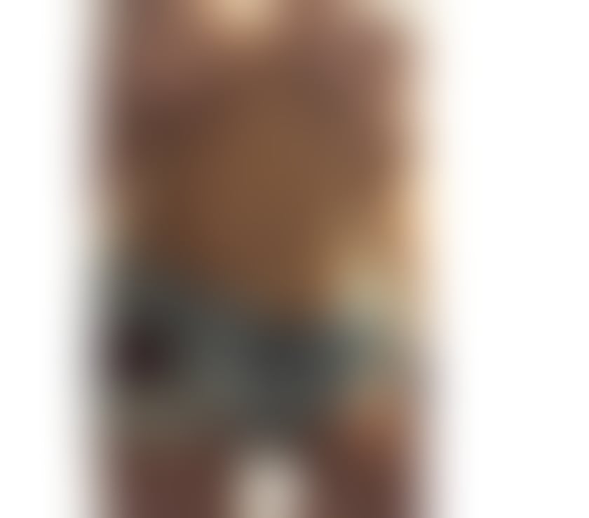 Escorts Edinburgh Edinburgh - Edinburgh - Photos for A MASSAGE IN JUST A FEW MINUTES CAN TRANSFORM YOUR DAY.