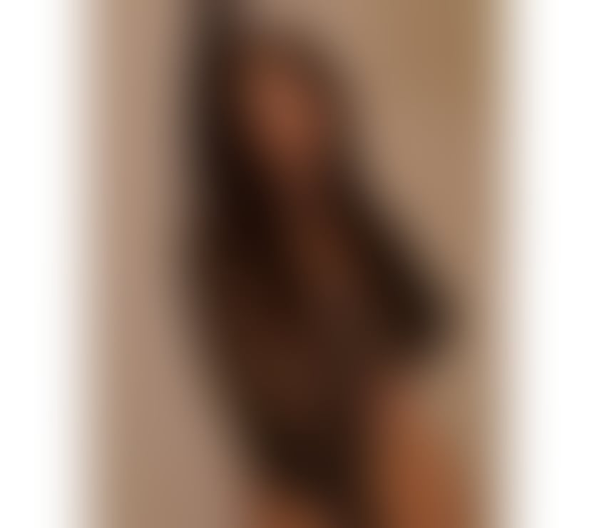 Escorts North Yorkshire Middlesbrough - Photos for 💝Luna💝 Fantasy 🫦💝Best service 💦💝