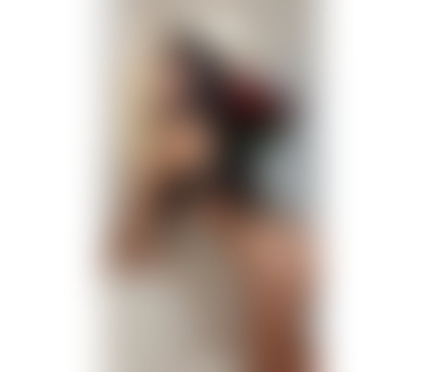 Escorts Glasgow Cumbernauld - Glasgow - Photos for 💯Genuine Real Escort💯Best service🔞Party Girl🥂