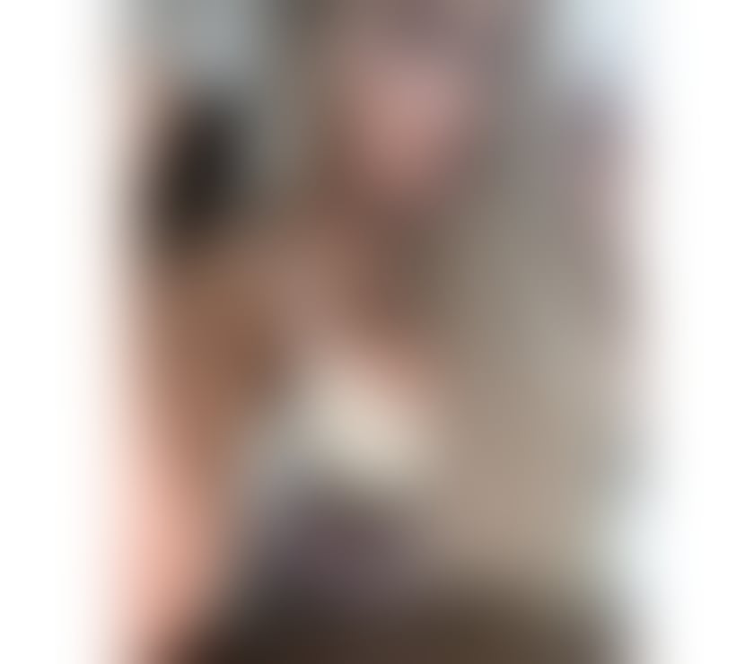 Escorts West Midlands Birmingham - Photos for 💎🔥 Zoe Brazilian luxury escort 💎🔥