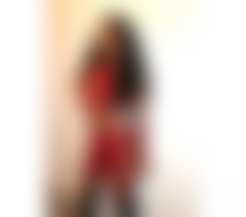 Escorts Fife Dunfermline - Fife - Photos for 🍓 💕⭐LARI THE BEST EXPERIENCE AVAILABLE 🍓