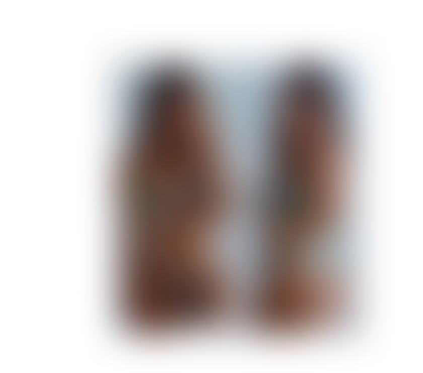 Escorts Staffordshire Stoke-on-Trent - Photos for 💋Angel🔥best gfe experience🍑Brazilian🇧🇷