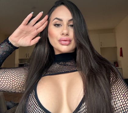 Escorts and Massages Derby City Centre Derby - Photos for ✨🫦 CHANTAL, SEXY GIRL 🥂❤️