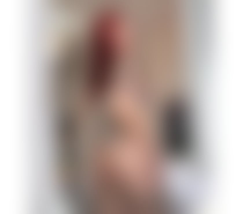 Brazilian Cherry 🍒 - Dartford