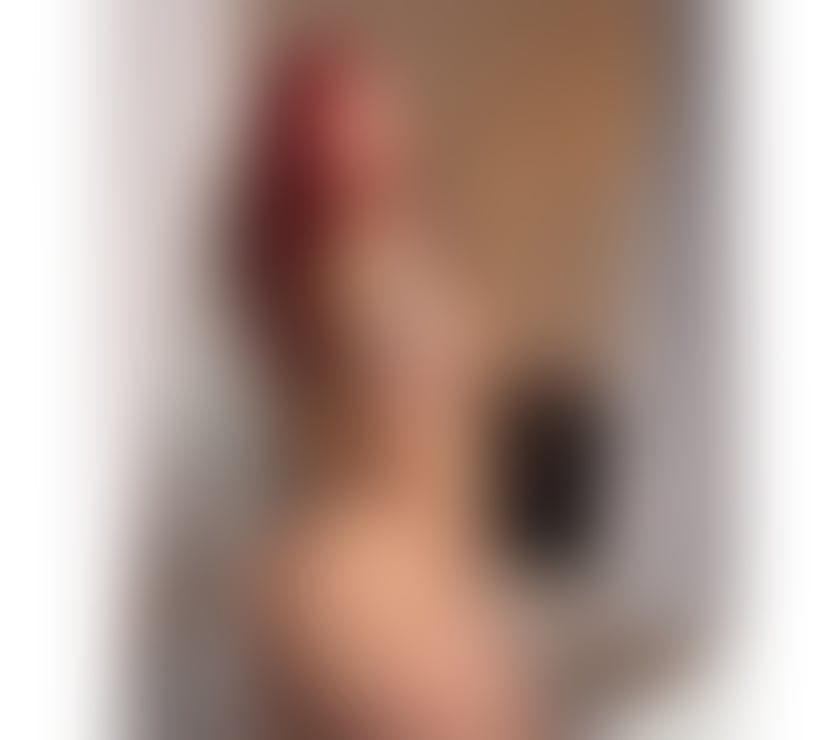 Escorts Kent Dartford - Photos for Brazilian Cherry 🍒 - Dartford