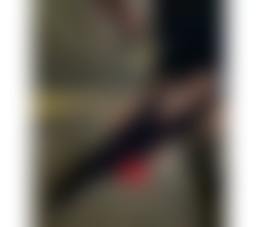 Escorts Edinburgh Edinburgh - Edinburgh - Photos for 🍾🫦24 H PARTY COLOMBIAN BEAUTY🇨🇴❤️🍾